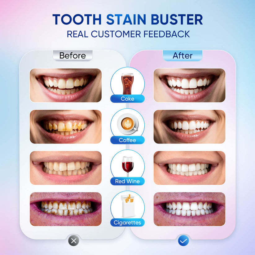 Niacinamide Whitening Toothpaste - For Healthier, Whiter Teeth!